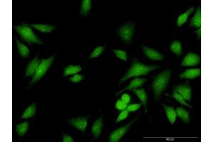 Immunofluorescence of purified MaxPab antibody to FES on HeLa cell.