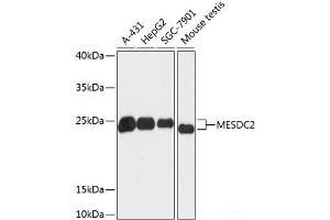 Western blot analysis of extracts of various cell lines using MESDC2 Polyclonal Antibody at dilution of 1:3000. (MESDC2 anticorps)