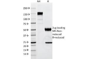SDS-PAGE Analysis Purified p57 Mouse Monoclonal Antibody (SPM308).