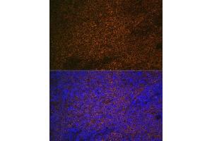 Immunohistochemistry of paraffin-embedded human tonsil using S100 Rabbit pAb (ABIN6129321, ABIN6147336, ABIN6147338 and ABIN6220958) at dilution of 1:350 (40x lens).