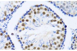 Immunohistochemistry of paraffin-embedded Mouse testis using DDX46 Polyclonal Antibody at dilution of 1:100 (40x lens). (DDX46 anticorps)
