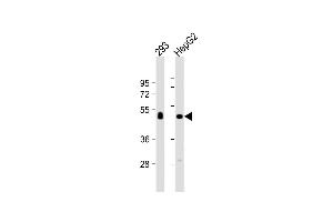 All lanes : Anti-CPVL Antibody (C-term) at 1:1000 dilution Lane 1: 293 whole cell lysate Lane 2: HepG2 whole cell lysate Lysates/proteins at 20 μg per lane.