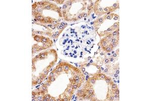 Immunohistochemical analysis of paraffin-embedded M. (BCL10 anticorps  (AA 1-143))