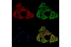 Phospho-LRP6 (Ser1420) Antibody staining Hela cells(heat shock treatment) by IF/ICC. (LRP6 anticorps  (pSer1420))