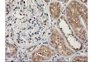 Immunohistochemical staining of paraffin-embedded Human Kidney tissue using anti-CAT mouse monoclonal antibody.