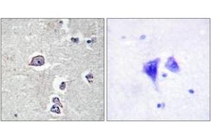Immunohistochemistry analysis of paraffin-embedded human brain tissue, using PDGFR alpha (Ab-754) Antibody. (PDGFRA anticorps  (AA 721-770))