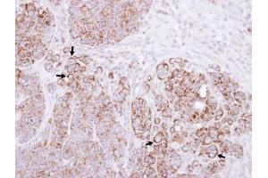 IHC-P Image Immunohistochemical analysis of paraffin-embedded SW480 xenograft , using Alpha-catulin, antibody at 1:100 dilution.