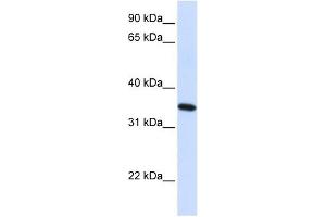 RTN1 antibody used at 1 ug/ml to detect target protein. (Reticulon 1 anticorps  (N-Term))