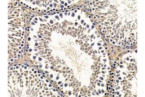 ABIN7093928 and ABIN7097972 at 1/100 staining rat testis tissue by IHC-P. (NHP2 anticorps  (Internal Region))
