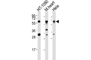All lanes : Anti-SMYD2 Antibody (N-term) at 1:2000 dilution Lane 1: HT-1080 whole cell lysates Lane 2: mouse heart lysates Lane 3: Hela whole cell lysates Lysates/proteins at 20 μg per lane. (SMYD2A anticorps  (N-Term))