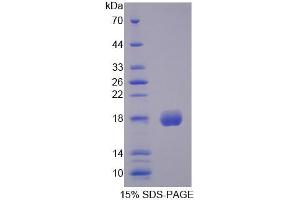 SDS-PAGE analysis of Human CFP Protein.
