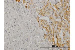 Image no. 1 for anti-CAMP Responsive Element Binding Protein 5 (CREB5) (AA 1-100) antibody (ABIN599087) (CREB5 anticorps  (AA 1-100))