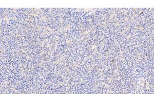 Detection of VCL in Human Spleen Tissue using Anti-Vinculin (VCL) Polyclonal Antibody