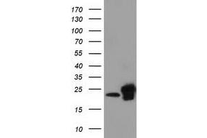 Western Blotting (WB) image for anti-Sjogren Syndrome/scleroderma Autoantigen 1 (SSSCA1) antibody (ABIN1501155) (SSSCA1 anticorps)