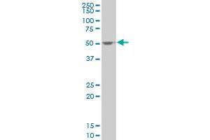 SSB polyclonal antibody (A01), Lot # FAK0060323QCS1 Western Blot analysis of SSB expression in HeLa .