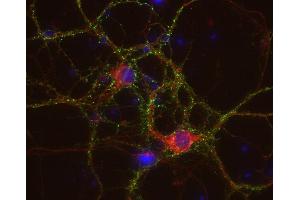 Indirect immunostaining of PFA fixed rat hippocampus neurons with anti-HCN 1 (dilution 1 : 500; red) and mouse anti-synapsin 1 (, dilution 1 : 500; green).