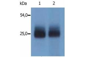 Image no. 1 for anti-Linker For Activation of T Cells Family, Member 2 (LAT2) (AA 124-203), (Cytoplasmic Domain), (N-Term) antibody (ABIN238344) (LAT2 anticorps  (Cytoplasmic Domain, N-Term))
