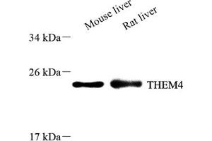 Western blot analysis of THEM4 (ABIN7075881),at dilution of 1: 600 (THEM4 anticorps)