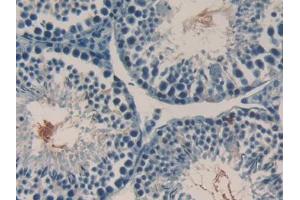 DAB staining on IHC-P; Samples: Mouse Testis Tissue (RANKL anticorps  (AA 92-263))