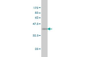 Western Blot detection against Immunogen (37.