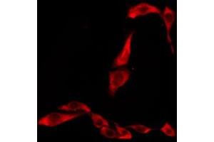 ABIN6276277 staining Hela by IF/ICC. (TAS2R45 anticorps)