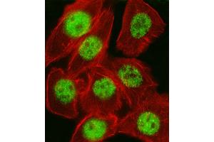 Fluorescent image of A549 cell stained with CDKN1A Antibody (C-term) (ABIN657391 and ABIN2846432).