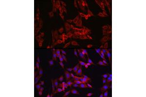 Immunofluorescence analysis of NIH/3T3 cells using Cyclin B1 Rabbit pAb (ABIN3022806, ABIN3022807, ABIN3022808 and ABIN6219237) at dilution of 1:150 (40x lens).