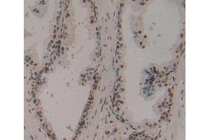 IHC-P analysis of Human Tissue, with DAB staining. (Ephrin A1 anticorps  (AA 19-182))