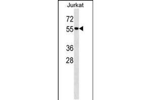Western blot analysis in Jurkat cell line lysates (35ug/lane).