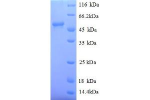 SDS-PAGE (SDS) image for Myc Proto-Oncogene protein (MYC) (AA 1-439), (full length) protein (His tag) (ABIN5709983)