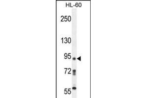 KRI1 Antibody (N-term) (ABIN654199 and ABIN2844048) western blot analysis in HL-60 cell line lysates (35 μg/lane). (KRI1 anticorps  (N-Term))