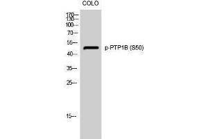 Western Blotting (WB) image for anti-Protein tyrosine Phosphatase, Non-Receptor Type 1 (PTPN1) (pSer50) antibody (ABIN3182605) (PTPN1 anticorps  (pSer50))