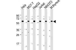 All lanes : Anti-Hsp60 Antibody at 1:2000 dilution Lane 1: Hela whole cell lysate Lane 2: MCF-7 whole cell lysate Lane 3: HepG2 whole cell lysate Lane 4: Jurkat whole cell lysate Lane 5: NIH/3T3 whole cell lysate Lane 6: mouse thymus lysate Lysates/proteins at 20 μg per lane.