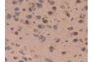 Detection of IL17RD in Rat Brain Tissue using Polyclonal Antibody to Interleukin 17 Receptor D (IL17RD) (IL17RD anticorps  (AA 356-605))