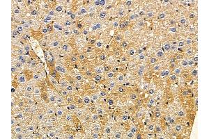 ABIN7094076 and ABIN7098120 at 1/100 staining mouse liver tissue by IHC-P. (ARMC10 anticorps  (Internal Region))