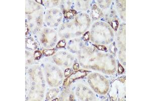 Immunohistochemistry of paraffin-embedded rat kidney using CASR antibody (ABIN1678994, ABIN5663902, ABIN5663904 and ABIN6218520) at dilution of 1:50 (40x lens). (CASR anticorps  (AA 874-1088))