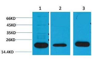 Western Blotting (WB) image for anti-Periaxin (PRX) antibody (ABIN3179015) (Periaxin anticorps)