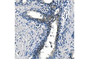 IHC analysis of ASS1 using anti-ASS1 antibody (ABIN7601191).