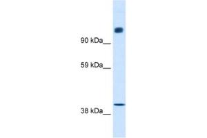 Western Blotting (WB) image for anti-Nuclear Receptor Co-Repressor 1 (NCOR1) antibody (ABIN2460482) (NCOR1 anticorps)