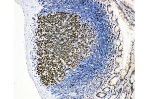 IHC-P: MCM2 antibody testing of rat intestinal lymphocyte tissue