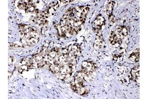 IHC analysis of Ran using anti-Ran antibody .