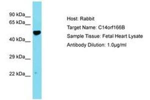 Image no. 1 for anti-Chromosome 14 Open Reading Frame 166B (C14ORF166B) (AA 26-75) antibody (ABIN6750760) (C14orf166B anticorps  (AA 26-75))