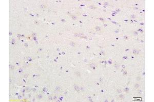 Formalin-fixed and mouse brain tissue labeled with Anti-IL12RB2 Polyclonal Antibody , Unconjugated at 1:200 followed by conjugation to the secondary antibody and DAB staining (IL12RB2 anticorps  (AA 301-400))
