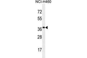 ZC3H15 Antibody (C-term) western blot analysis in NCI-H460 cell line lysates (35 µg/lane).