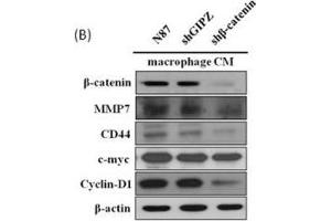 (A) Effect of macrophage CM on mRNA and protein expression of β-catenin down-stream genes. (c-MYC anticorps  (Center))