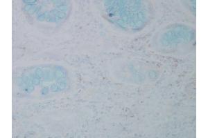 Immunohistochemistry analysis using Mouse Anti-Nitrotyrosine Monoclonal Antibody, Clone 39B6 .