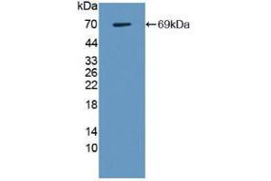 Image no. 3 for Lectin, Galactoside-Binding, Soluble, 9 (LGALS9) (AA 1-355) (Active) protein (His tag,GST tag) (ABIN6239815)