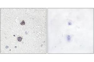 Immunohistochemistry analysis of paraffin-embedded human brain, using Aquaporin 2 (Phospho-Ser256) Antibody. (AQP2 anticorps  (pSer256))
