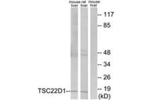 Western blot analysis of extracts from mouse liver/rat liver cells, using TSC22D1 Antibody. (TSC22D1 anticorps  (AA 71-120))