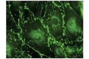 Immunostaining of primary RPE cells with CX43 Ab at 1/100 dilution. (Connexin 43/GJA1 anticorps  (C-Term))